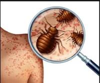 West Palm Beach Bed Bug Exterminators image 4